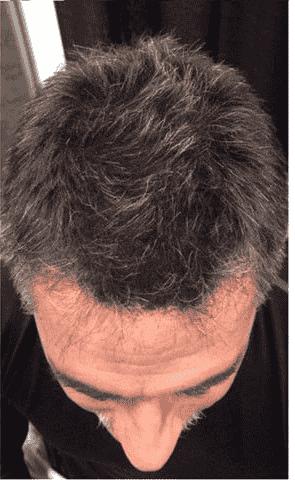 KorinMi Korean Express Korean Hair Spa For Men